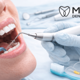 Deep Teeth Cleaning