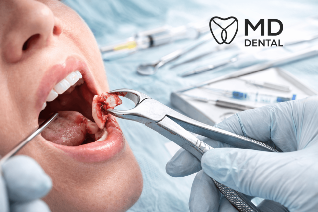 Oral Surgery